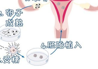 四川三代试管婴儿基本费用是多少？附上详细流程和费用明细